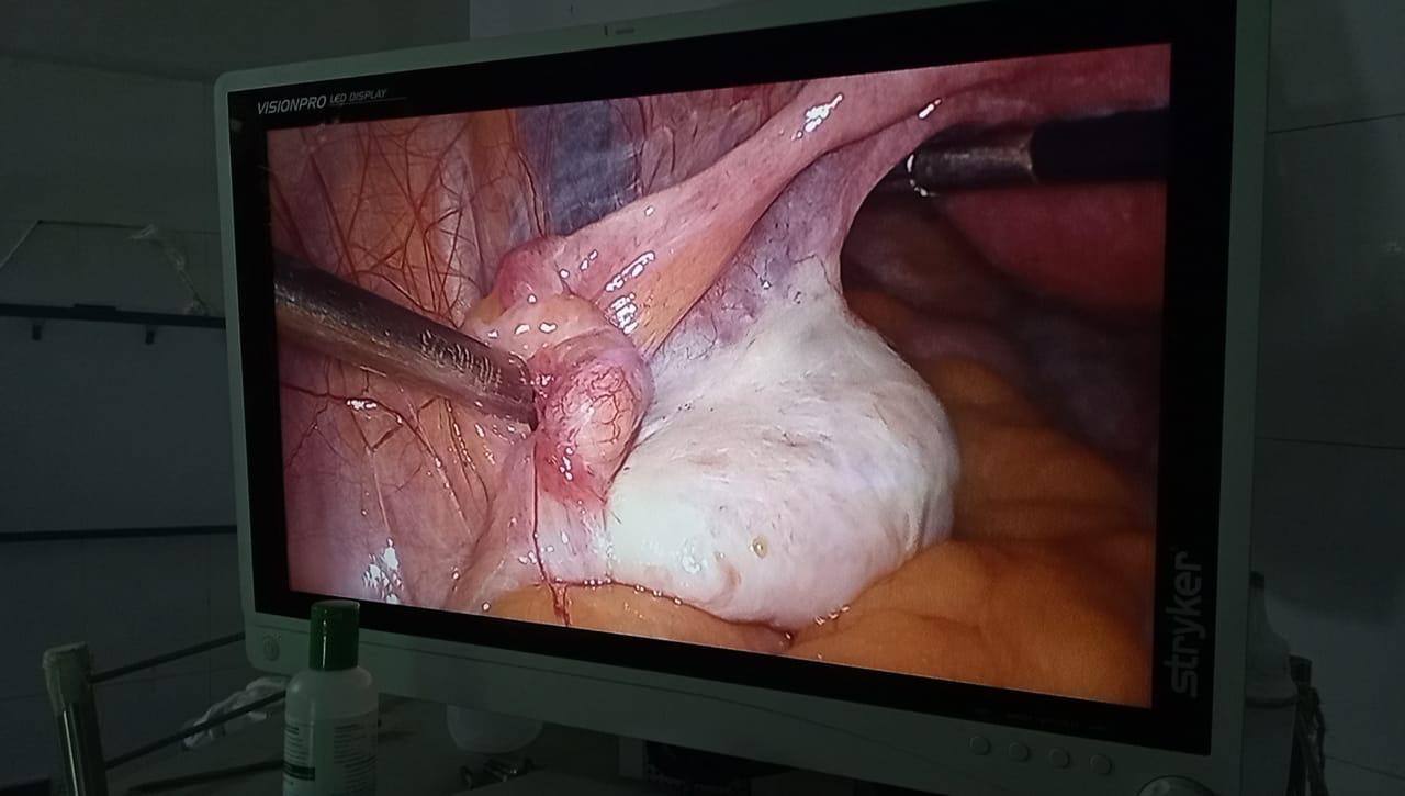 Laparoscopy equipment