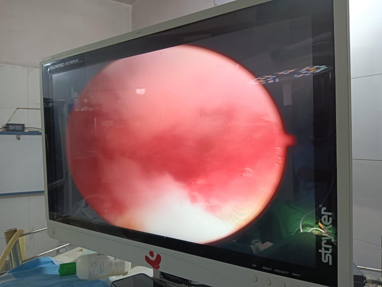 Hysteroscopy